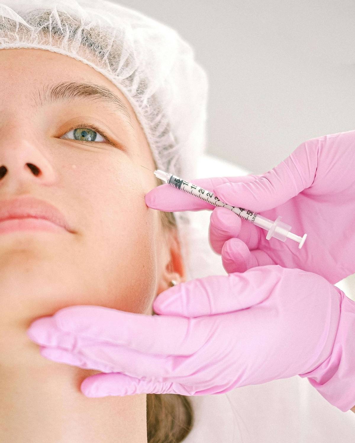 Masseter Botox Before and After What to Know About the Jawline Treatment Everyone Talks About